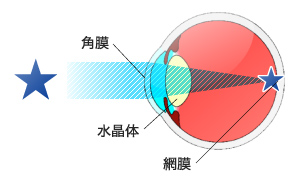 目：模式図