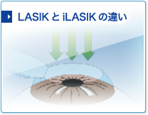 LASIKとiLASIKの違い