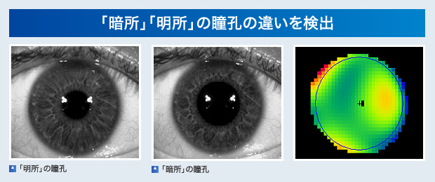 「暗所」「明所」の瞳孔の違いを検出：「明所」の瞳孔 / 「暗所」の瞳孔 / サーモグラフィー